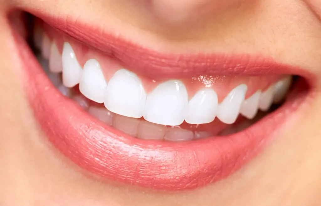 korony cyrkonowe w Alanyi — Alanya Dental Place